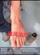 案例十