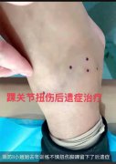 案例八