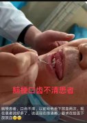 案例九